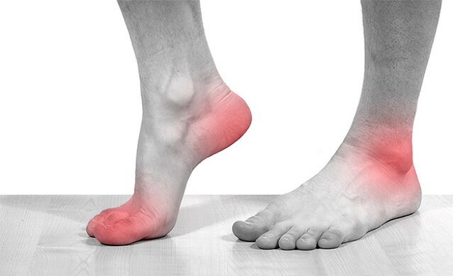 dolor en la articulación del tobillo con artrosis