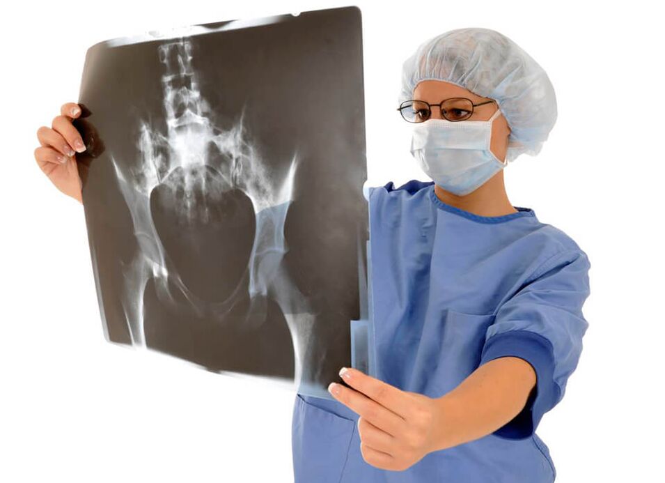 Una radiografía de la articulación de la cadera ayudará al médico a determinar la causa del dolor. 