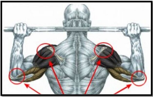 La carga sobre los músculos del hombro y el codo es una de las causas de la artrosis de la articulación del hombro. 